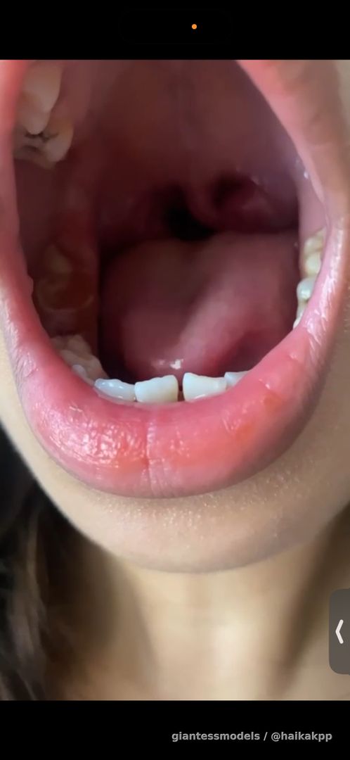 Thai girl show her mouth