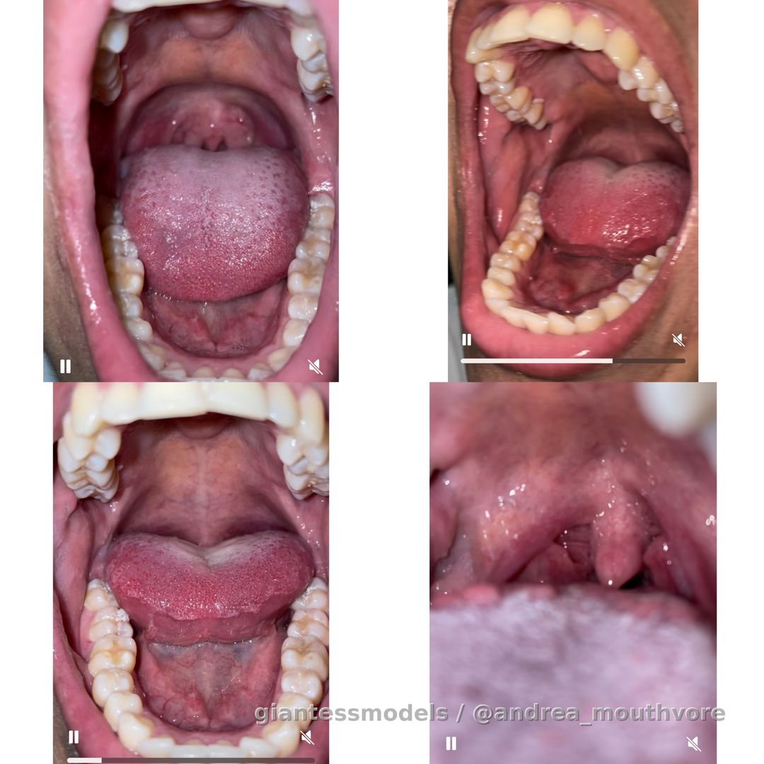 Video big open mouth, epiglottis, uvula 