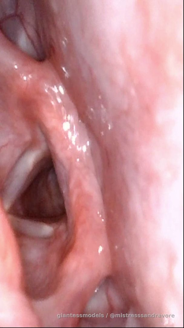 Meet my vocal chords (: