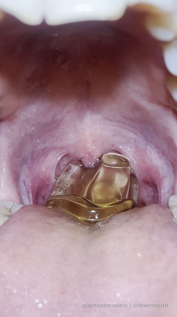 Girl swallowing jelly