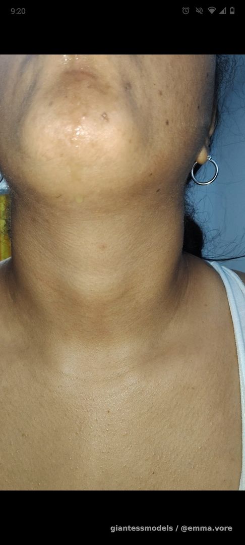 SWALLOWING WHOLE LARGE PIECES OF KIWI🥝🥝         #KIWI. #NECK #THROAT