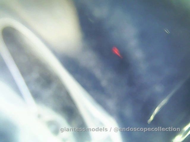 Giantess sucks on endocam