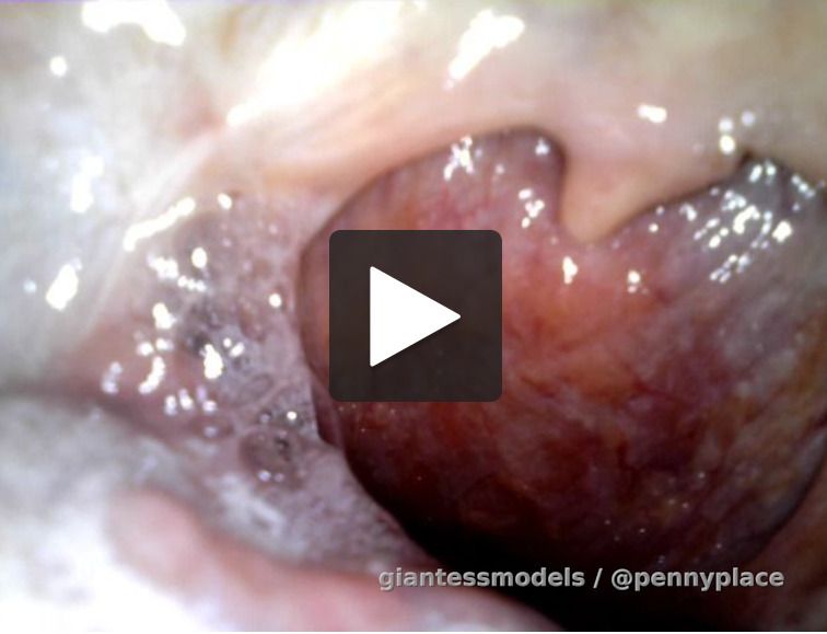 Holy uvula. Endoscope depstech camera used. Views of my mouth teeth opening and closing until the endoscope camera reaches in goes down my tongue and views my uvula. Lots of throat movements tongue movements teeth. Some drool and wet lips. One point of the video I have a large stream of spit stuck to my uvula. Enjoy all these views!