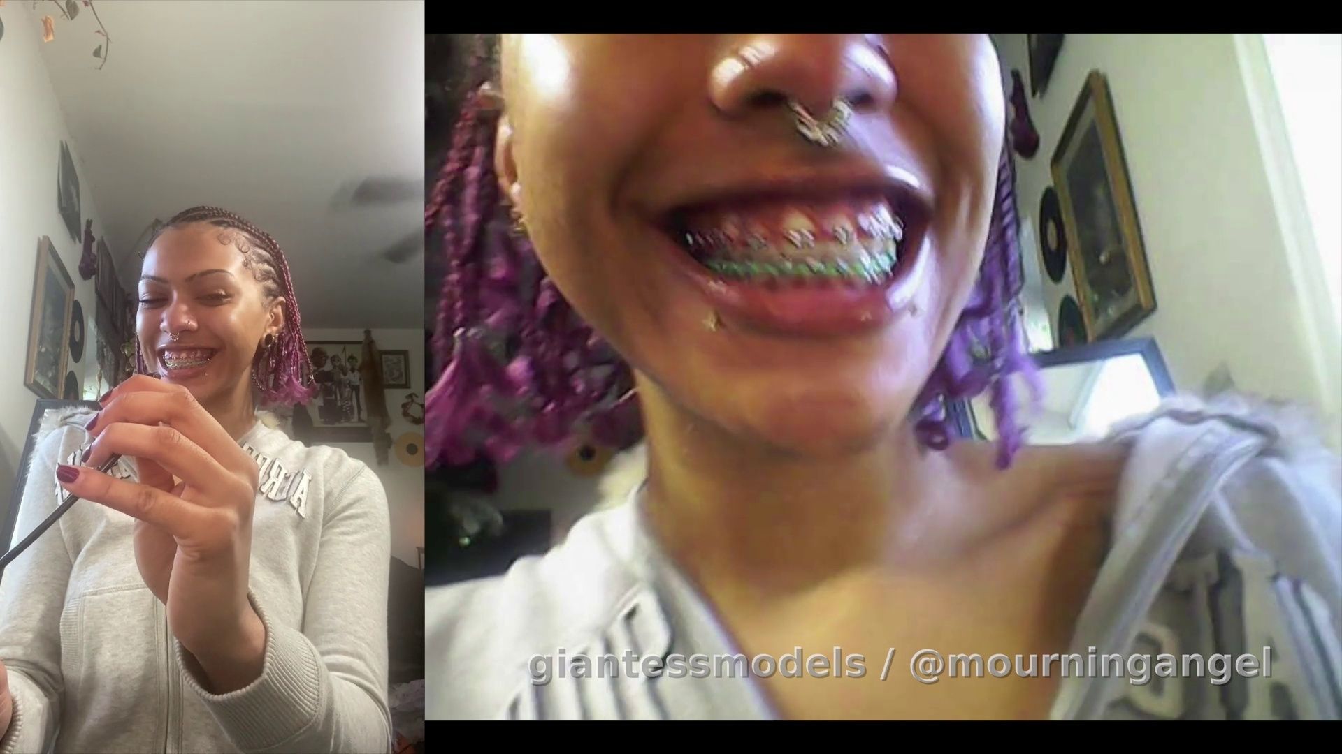 Tour of my teeth