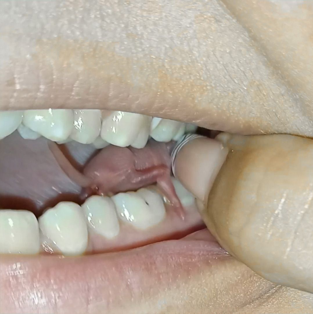 BA - Brutal Accent #1: In this series, I'm using AI and neural networks to:
a) stabilize image
b) enhance video quality
c) add frames up to 120fps

It's the main, 