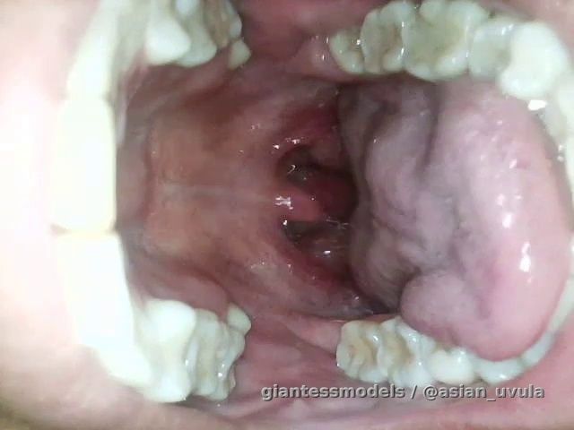 Endoscope view
