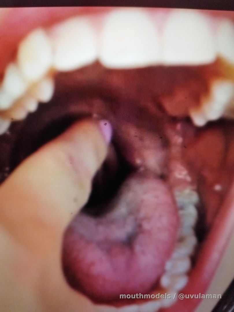 Big mouth uvula play after eating
#uvula #giantessvore #mouthfetish #fetish #openthroat #uvulafetish #uvulaplay #hotdogswallow #nochewing #openmouth
