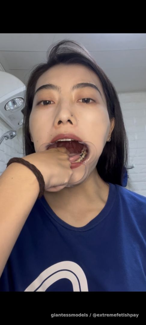 Gagging and vomit, open mouth