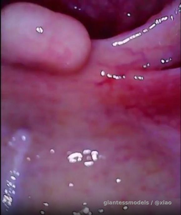 Sinus view