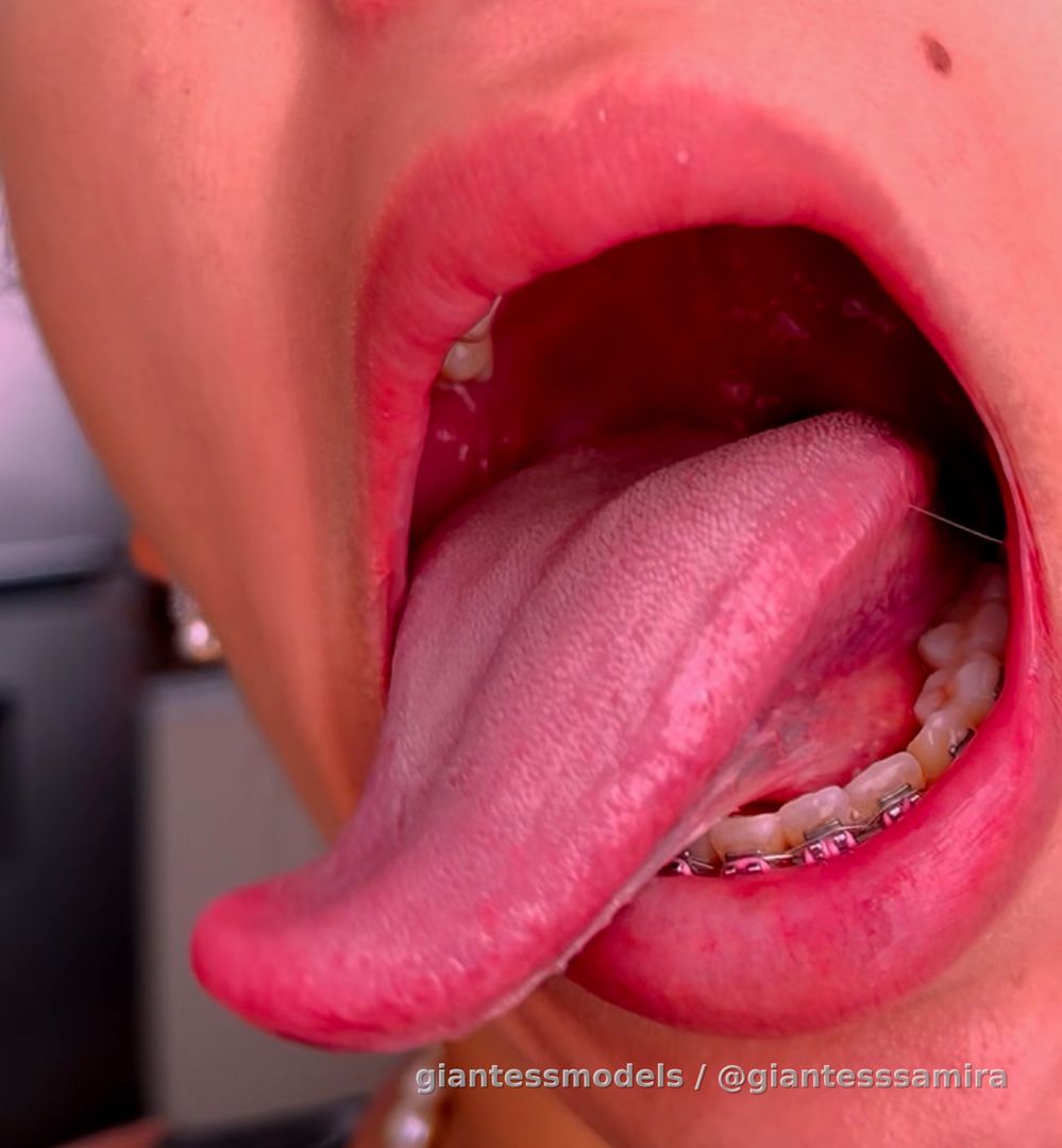 My tongue