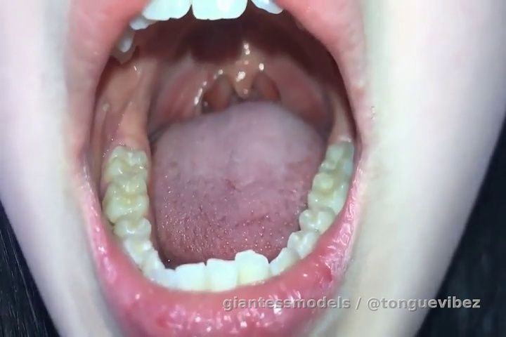 Prettyy Wide Mouth Nastyy Drooling Uvula Viewz