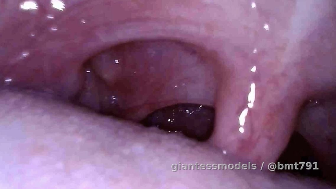 MT endo mouth tour 3