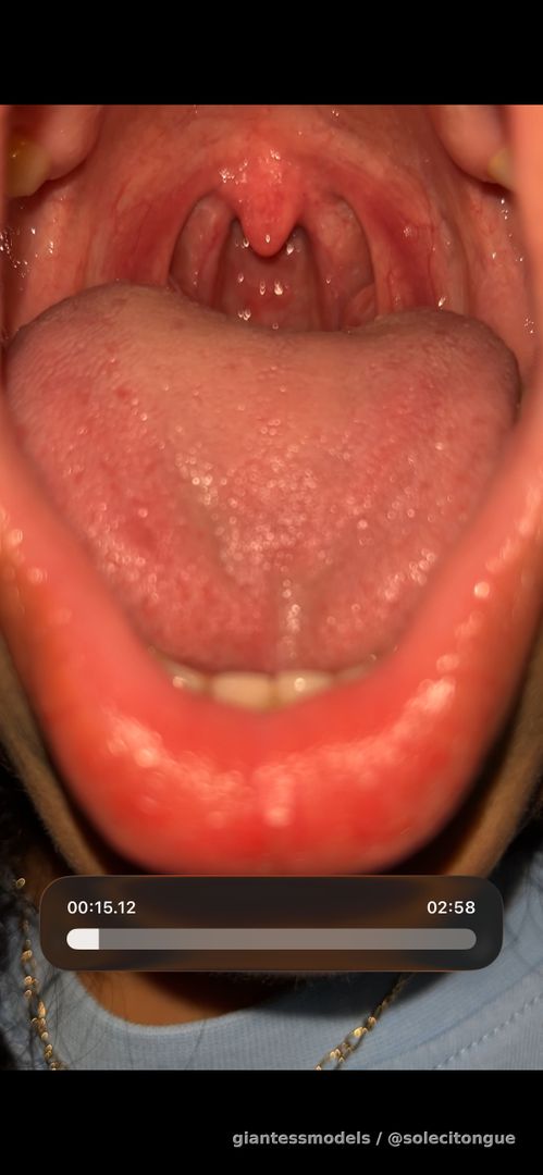 Tongue and uvula very close for 3 minutes👅