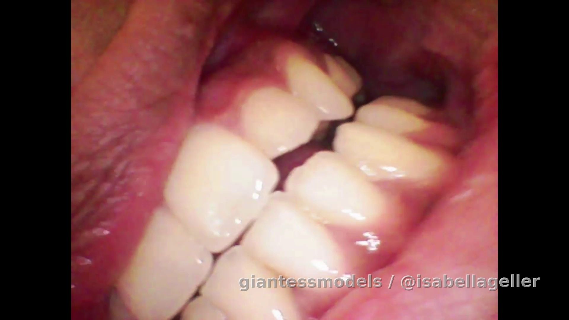 Endoscope teeth 