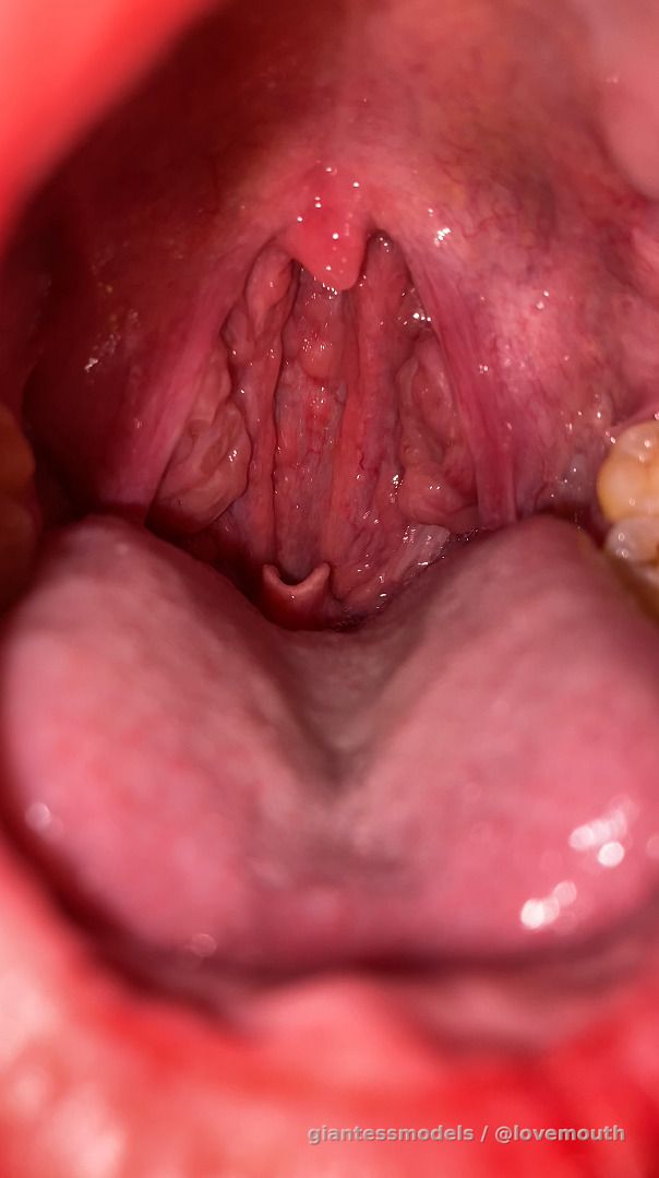 Girl shows her throat and keeps retching