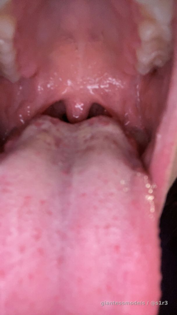 100 PHOTOS! Hehehehehe