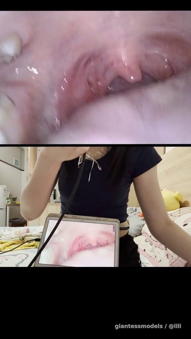 Pill endoscope