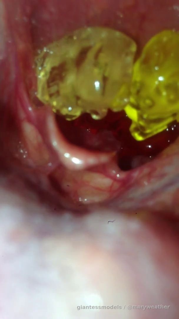 Four gummies and one big gummy disappear