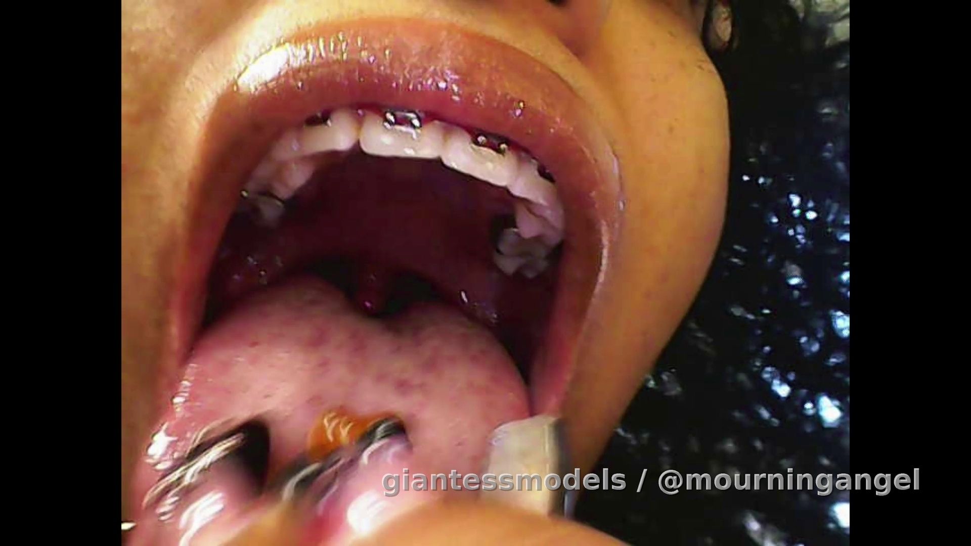 Endoscope gummy vore with sound