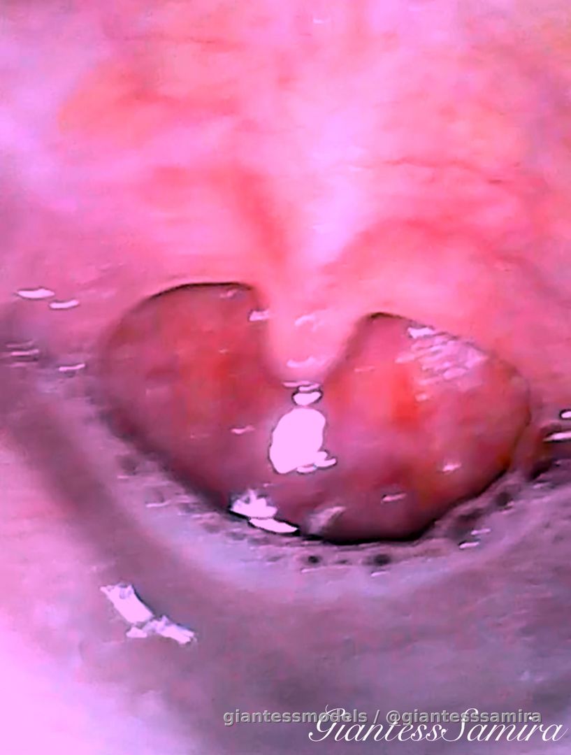 Endoscope. Deep throat. Lots of saliva and bubbles. Uvula
