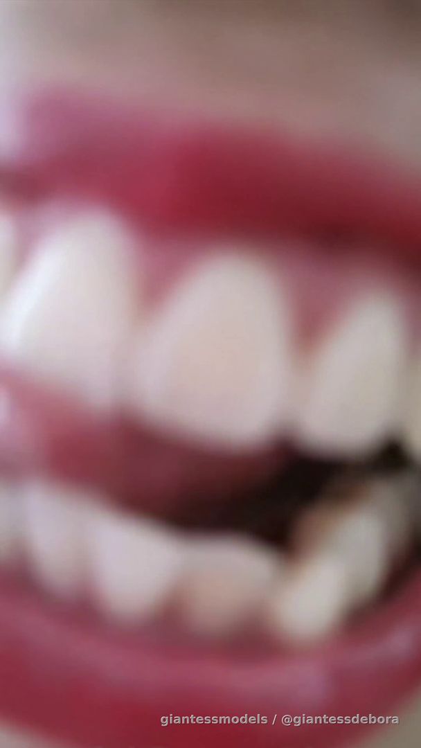 White Teeth