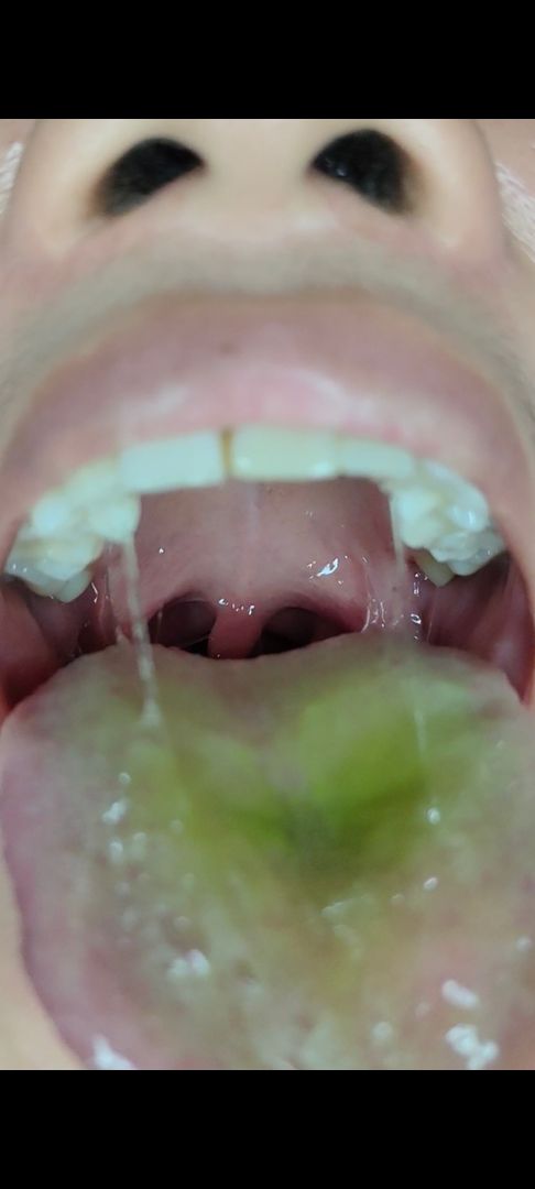 Green gummy play