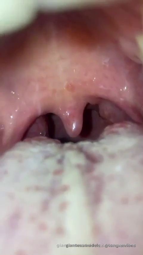 Insanee Close Up Wet Uvula Viewz 