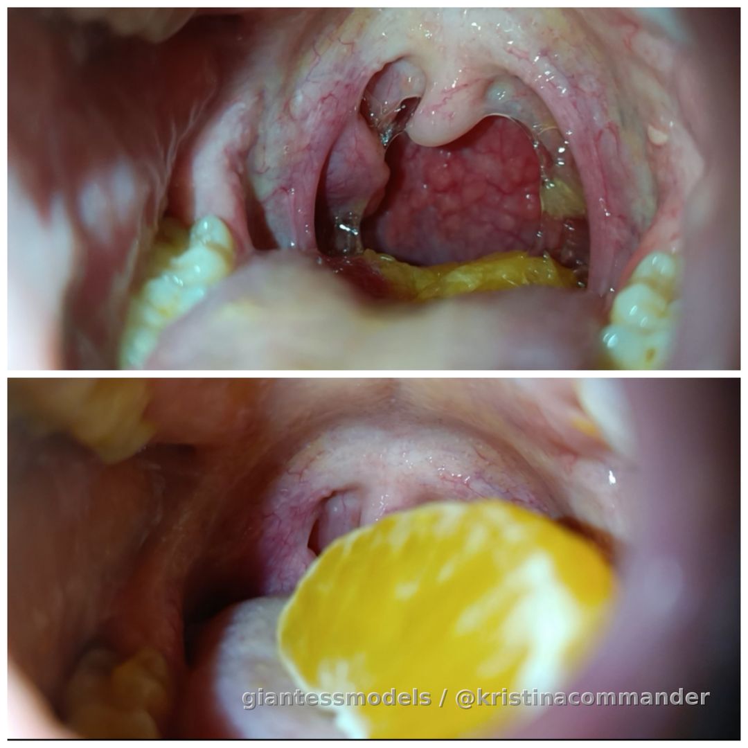 Swallowing + chewing fruit (video 3 mins)