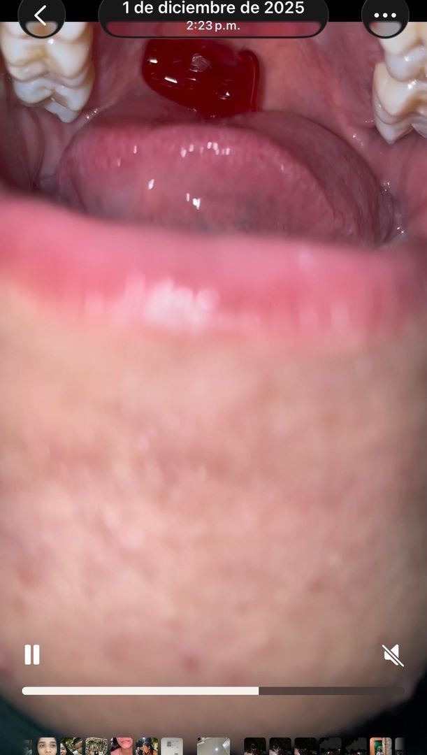 Vídeo gigant, swallow gummy! Crush feet