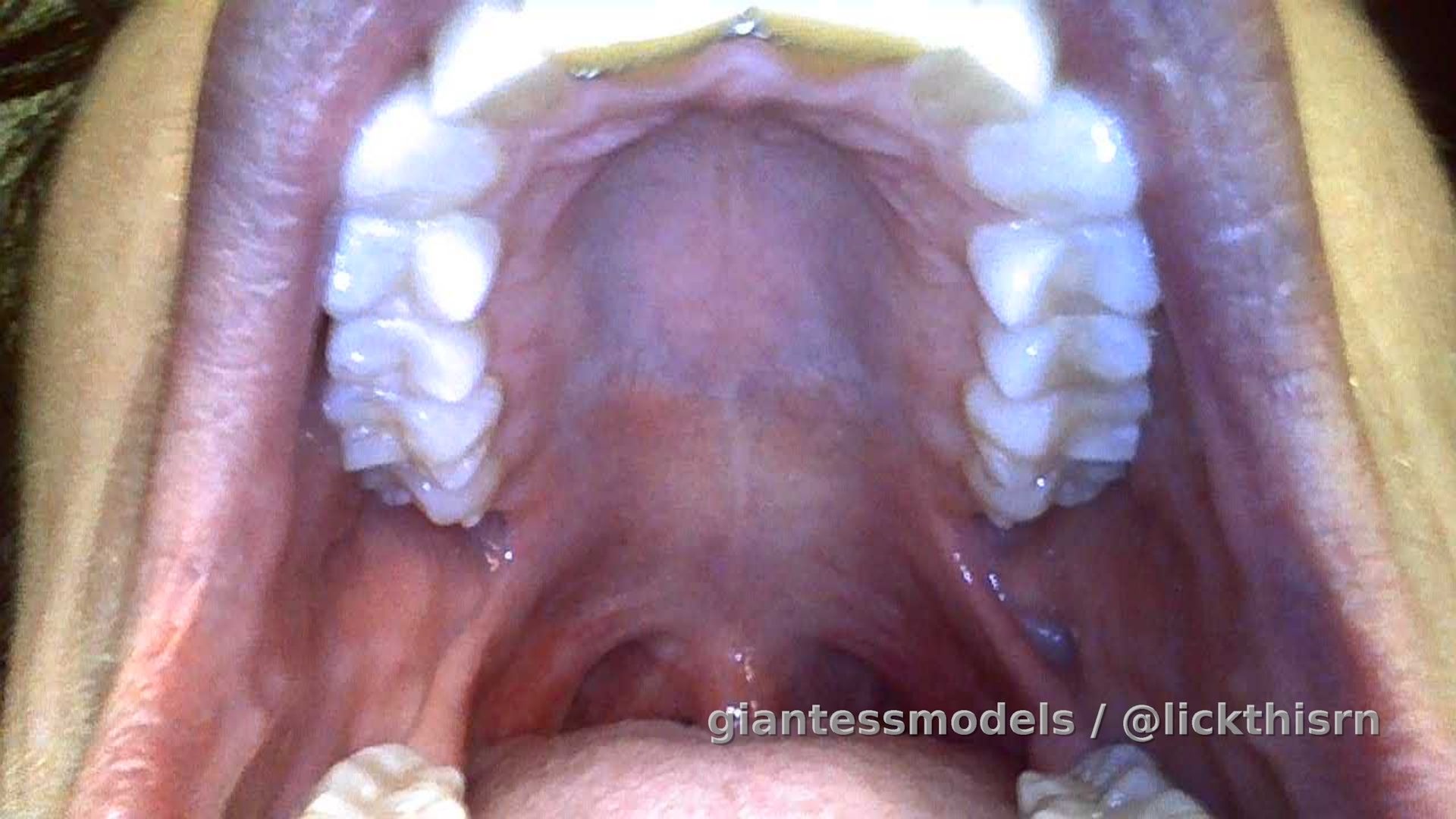 8 min endoscope mouth tour. Narrated by yours truly. Caution ⚠️ tonsils stones (removal with finger), uvula, double gummy bear swallow, close up. 