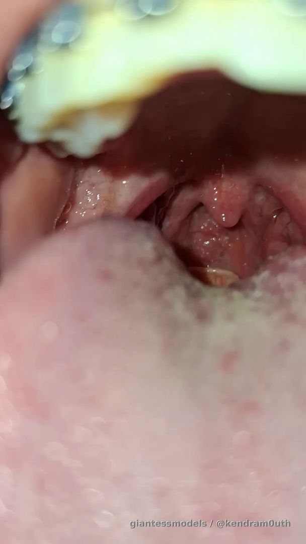 Showing epiglottis♥️