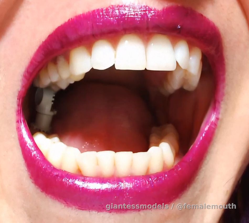 LEGO 4273 (axles) VS a full grown, mature woman... those small, innocent bricks stand no chance inside her powerful mouth! Yes, women have amazing closing power between their jaws, it's unbelievable how strong a female mouth actually is! As you can see, plastic reacts more like a yellow cheese when pressed and compressed between those rocky, diamond hard pearly whites... imagine the massacre this woman could make from your fingers in there!