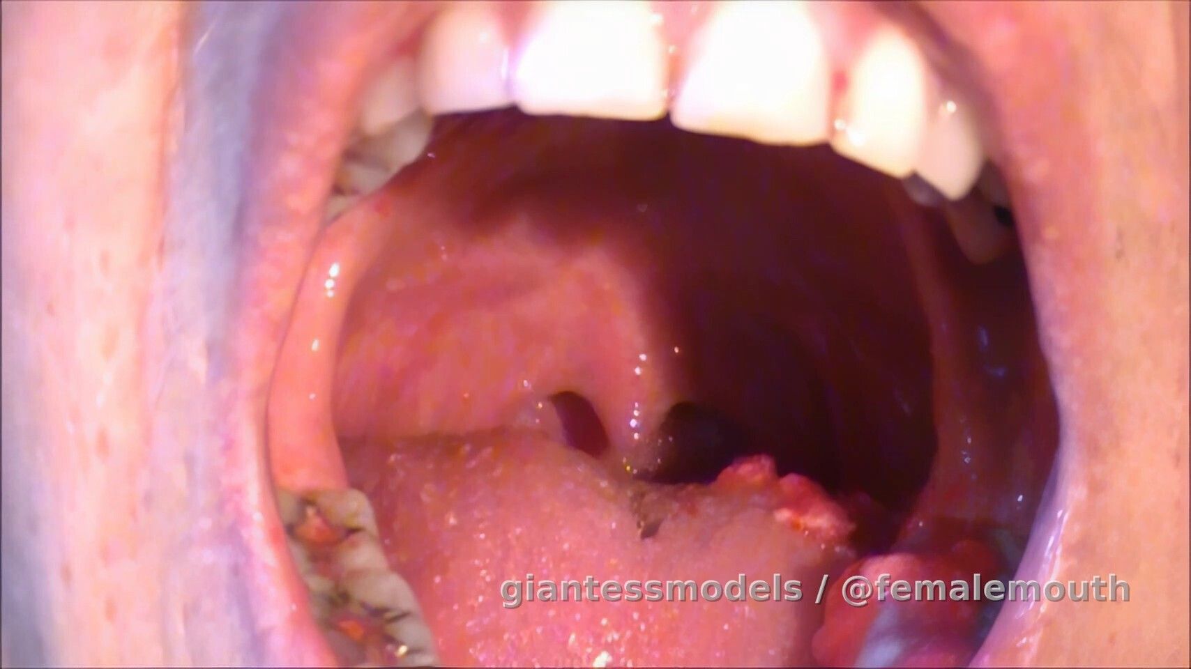 Eating yummy treat with nice amalgam covered teeth!