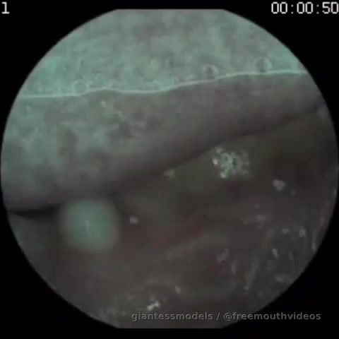 Girl swallow pill endoscopy full recording scat warning later