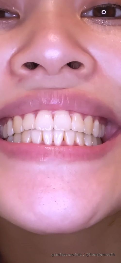 Big mouth with sharp teeth. Girl unknown, throat show, palate show and those SHOVEL like front incisors! So strong!!!