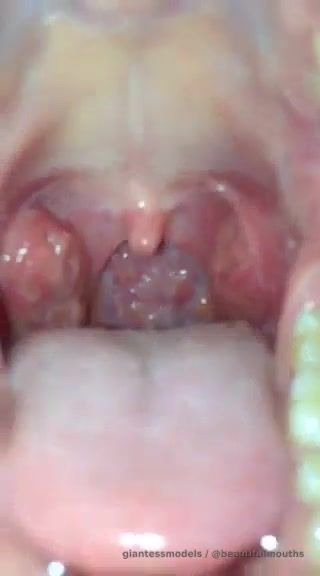 Throat view