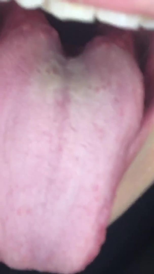Colombian girl uvula