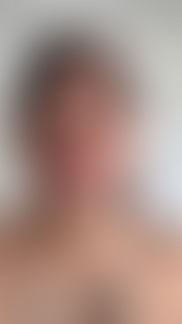 Long tongue more uvula