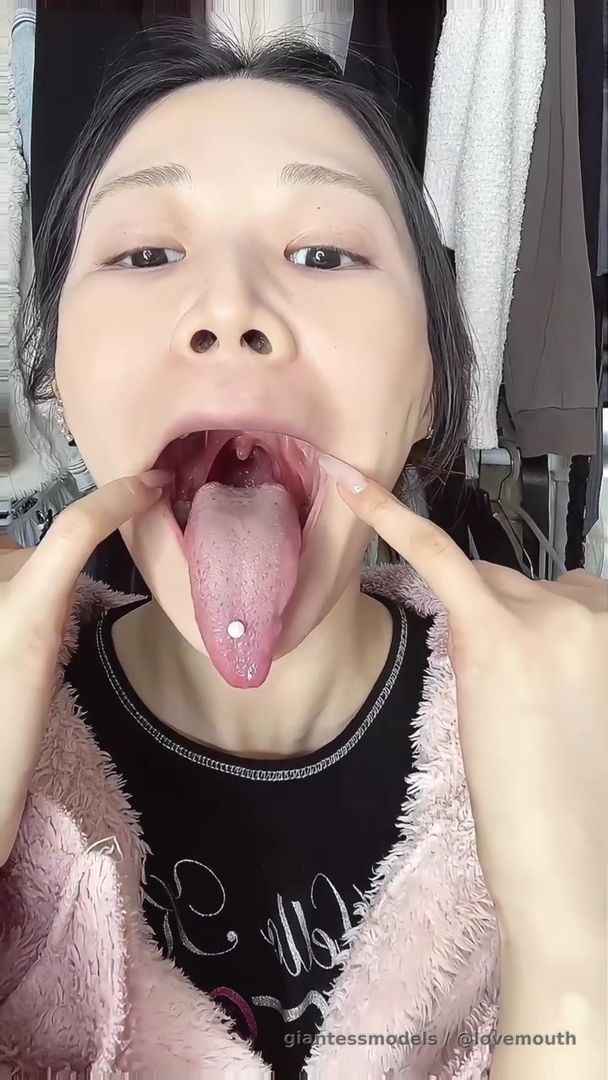 The girl swallowed yogurt and noodles, then vomited them up.