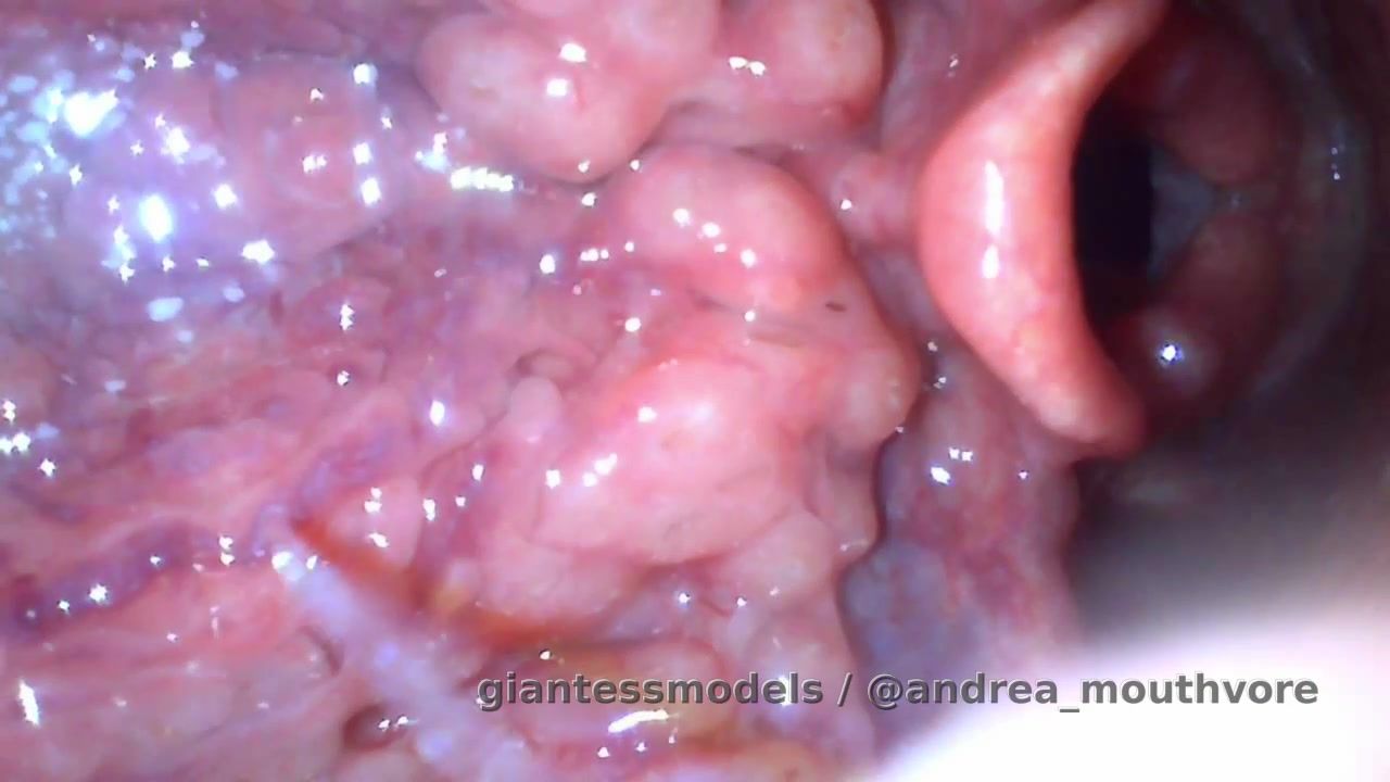Look at my epiglottis and my vocal cords!! Dm for custom!