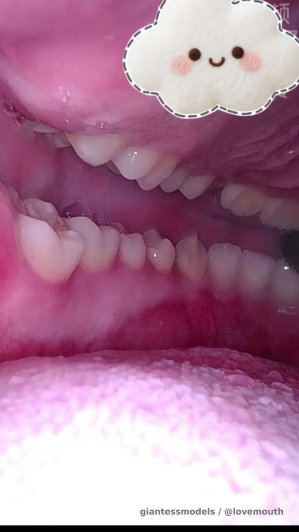 The girl swallowed a toy and underwent a gastroscopy.