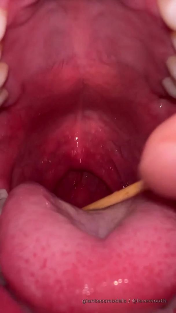 Stimulation of the girl's uvula caused her to gag.