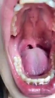 Thai college show her mouth and uvula 