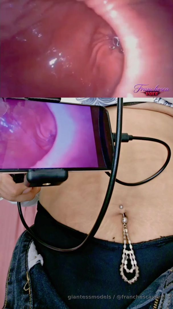 Follow the endoscope deeper than ever as the journey continues beyond the stomach