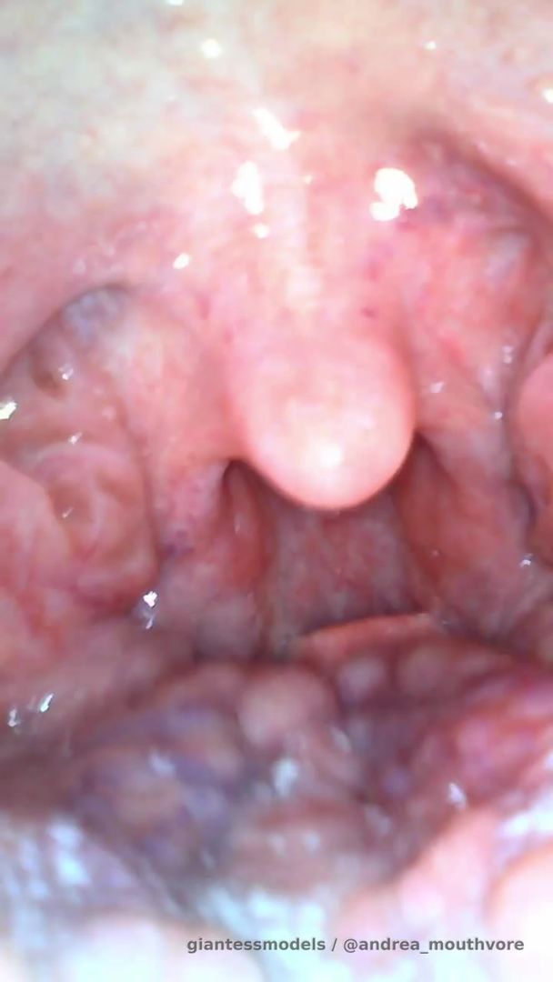 Endoscopy video!! Dm for custom!!! 