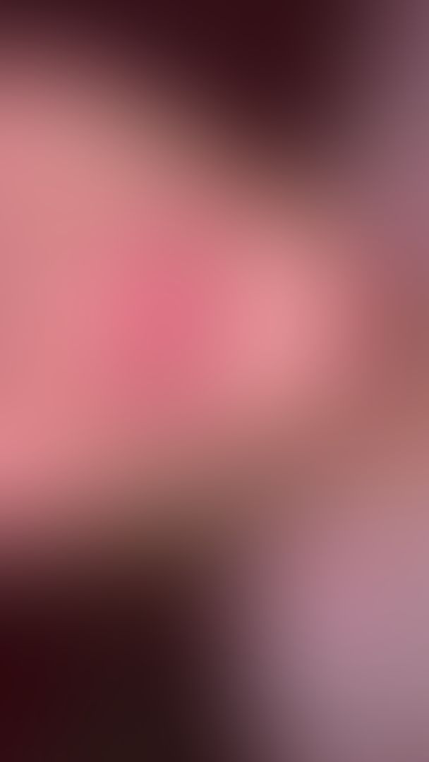 Mouth Tour👀 Also will have an endoscope soon so I can show you more in depth😉
