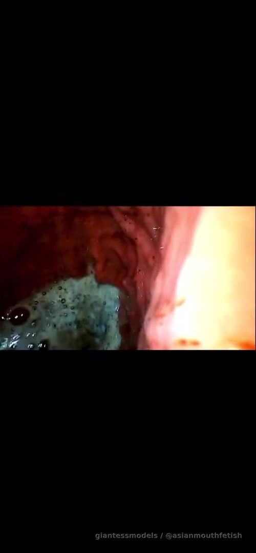 After swallowing the mouse, the mouse is frantically looking for a way to get out in the stomach.