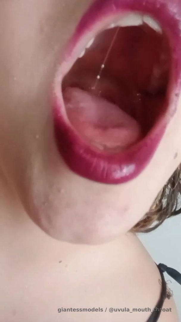 Colombian girl bifid uvula