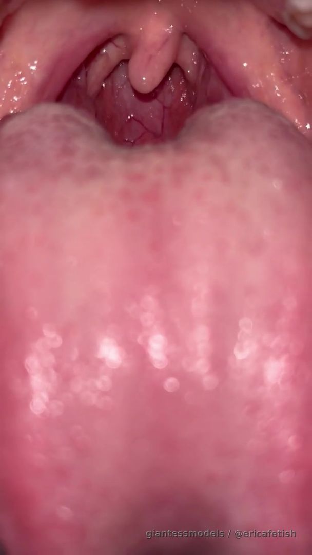 Dm for custom baBy! See My beautifull mouth 
